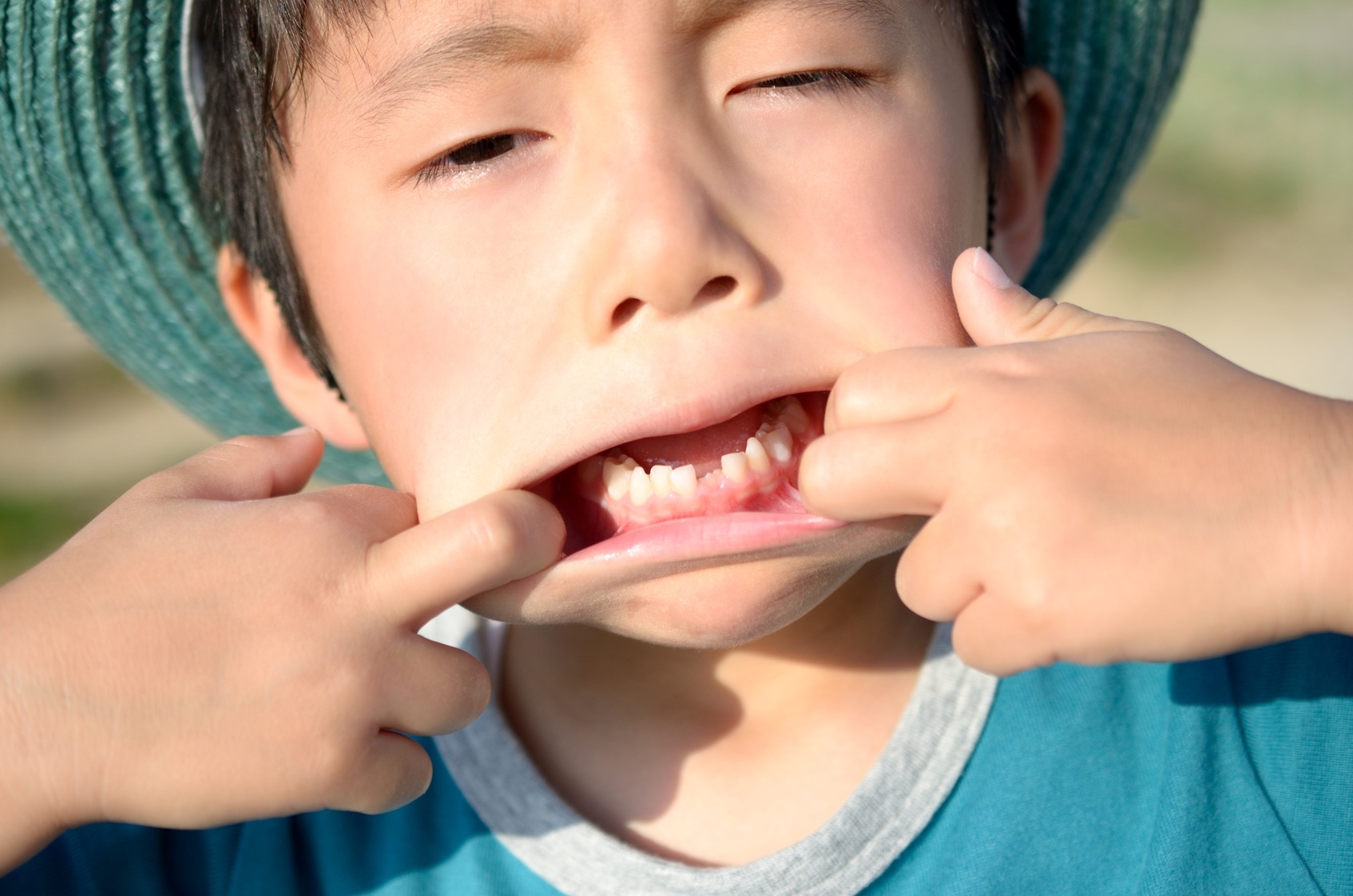 ⼦供の⻭科矯正